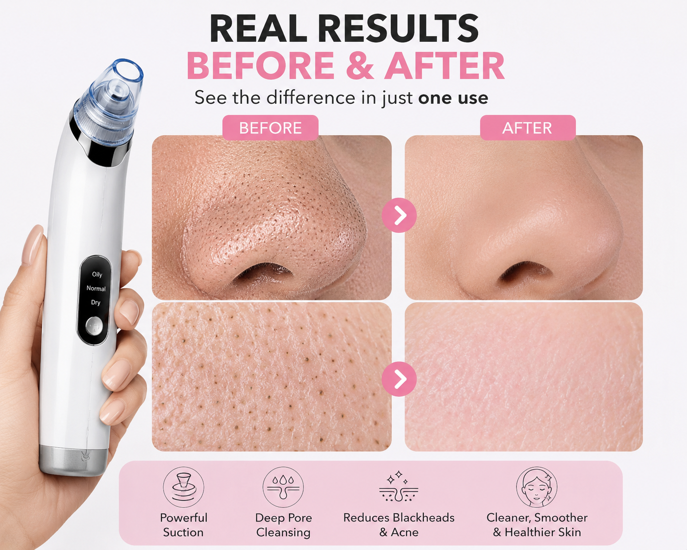 PoreVac Pro™ Deep Pore Cleanser