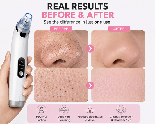 PoreVac Pro™ Deep Pore Cleanser